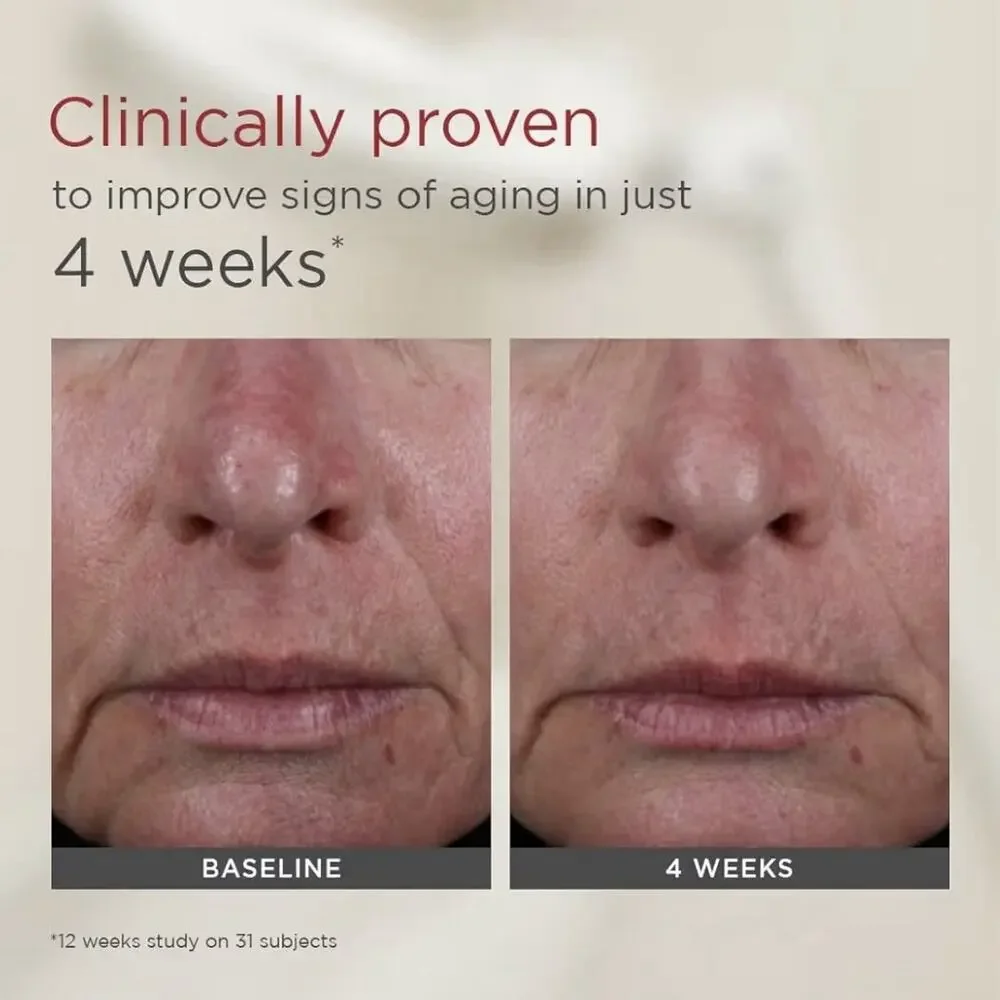 Elta Md elta md